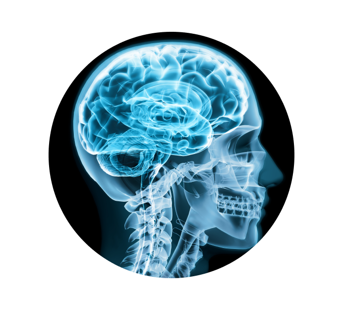 Рентген черепа