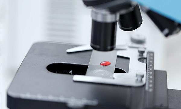 Анализ крови на амилазу Анализ крови на амилазу