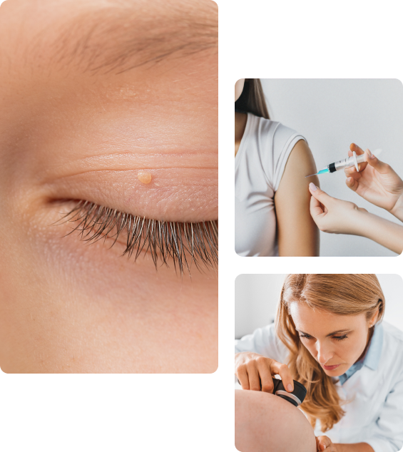 Осложнения после прививки от ВПЧ Осложнения после прививки от ВПЧ