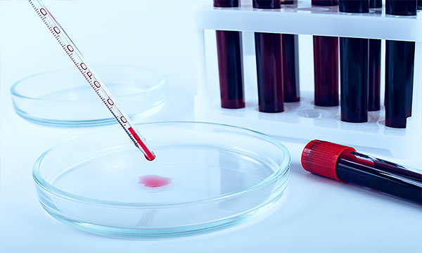 Анализ ретикулоцитов в крови Анализ ретикулоцитов в крови