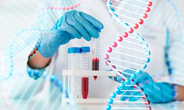 Анализ крови на антитела к брюшному тифу (метод РПГА)