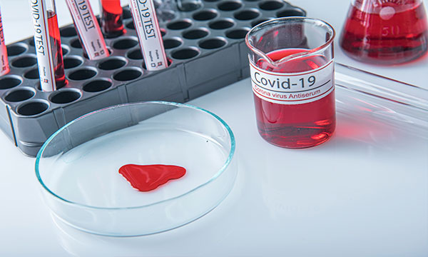 Анализ на антитела класса G (IgG) к S-белку коронавируса (SARS-CoV-2) в крови (в том числе поствакцинальные) Анализ на антитела класса G (IgG) к S-белку коронавируса (SARS-CoV-2) в крови (в том числе поствакцинальные)