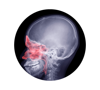 Рентген пазух носа Рентген пазух носа