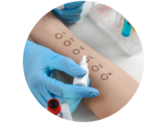 Аллерголог