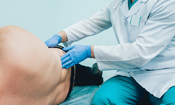 Катетеризация мочевого пузыря (мужчины) Катетеризация мочевого пузыря (мужчины)