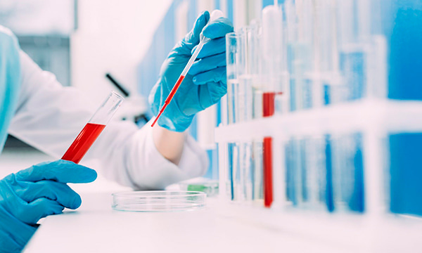 Исследование протромбинового (тромбопластинового) времени в крови/плазме (ПТИ), международного нормализованного отношения (МНО) Исследование протромбинового (тромбопластинового) времени в крови/плазме (ПТИ), международного нормализованного отношения (МНО)