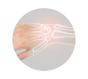 УЗИ лучезапястного сустава УЗИ лучезапястного сустава