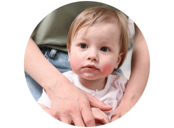 Детский аллерголог