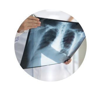 УЗИ вилочковой железы УЗИ вилочковой железы