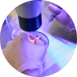 Биопсия слизистой носа Биопсия слизистой носа