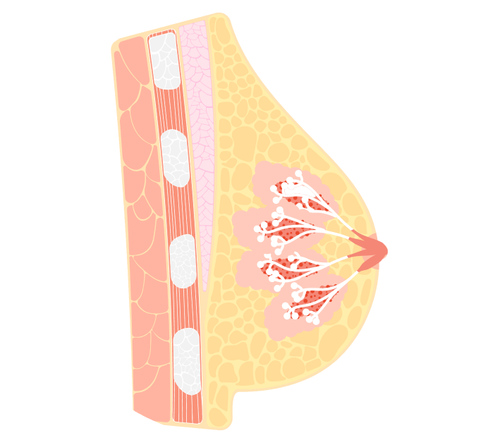 УЗИ молочных желез УЗИ молочных желез