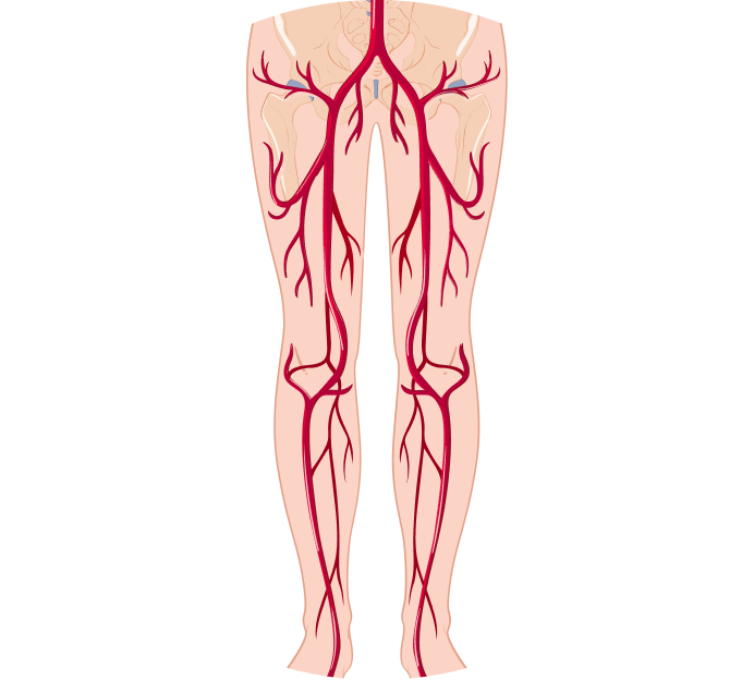 УЗИ сосудов нижней конечности УЗИ сосудов нижней конечности