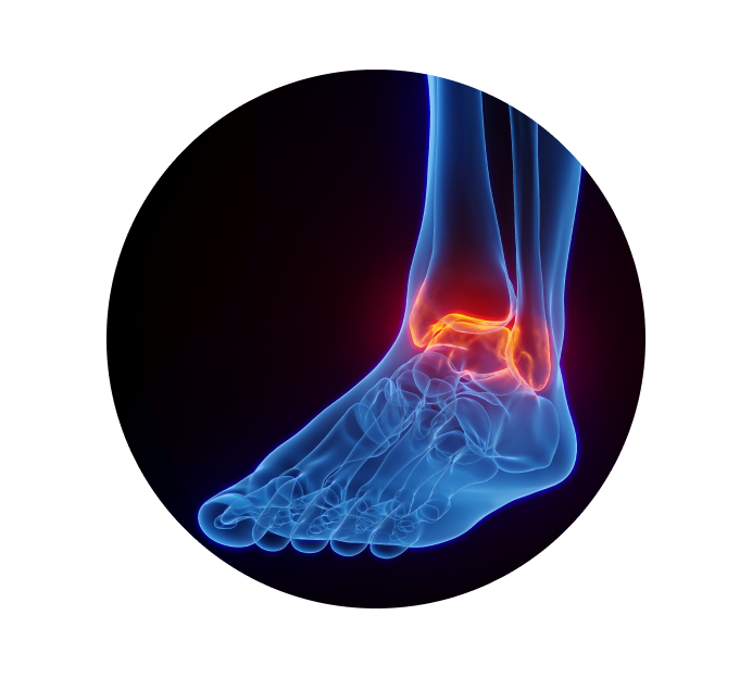 Рентген голеностопного сустава Рентген голеностопного сустава