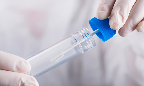 Анализ кала методом обогащения на гельминты Анализ кала методом обогащения на гельминты