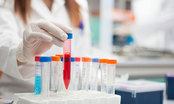 Исследование уровня С3 фракции комплемента в крови