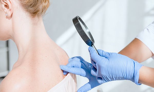 Удаление милиумов кожи Удаление милиумов кожи