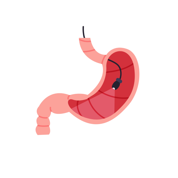 Подготовка к гастроскопии (ФГДС,ЭГДС) Подготовка к гастроскопии (ФГДС,ЭГДС)