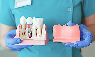 Удаление постоянного зуба сложное с разъединением корней (с отслаиванием слизисто-надкосничного лоскута)