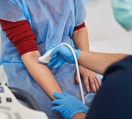 УЗИ вен верхней конечности УЗИ вен верхней конечности