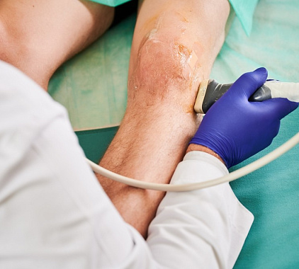 УЗИ колена УЗИ колена