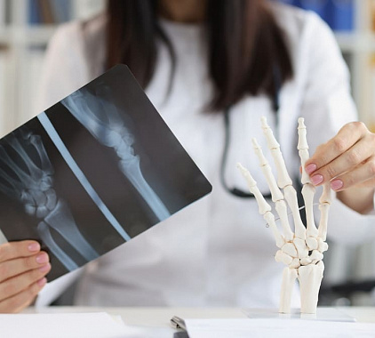 Рентгенография