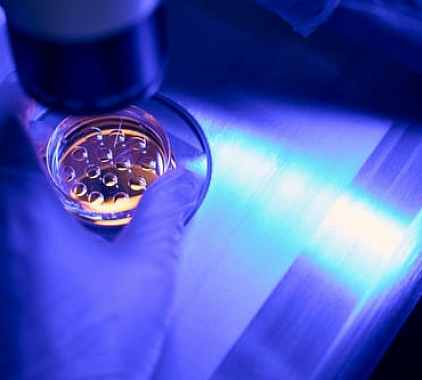 Биопсия Биопсия