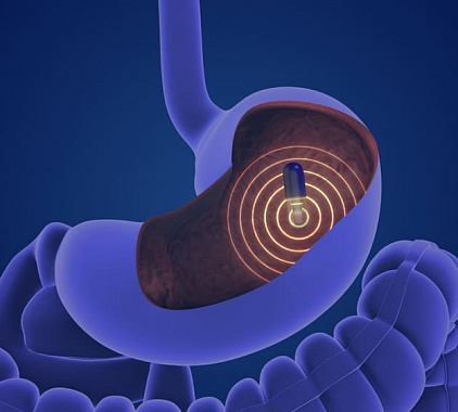 Эндоскопия Эндоскопия