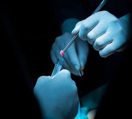 Биопсия Биопсия