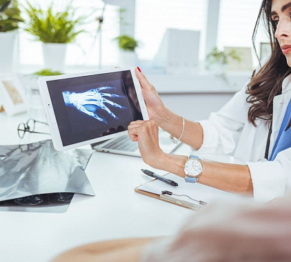 Рентгенография