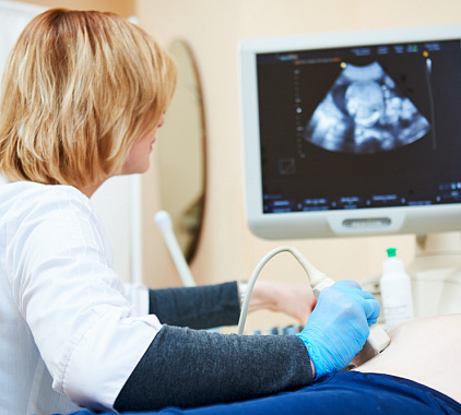 УЗИ плода