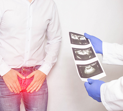 УЗИ предстательной железы