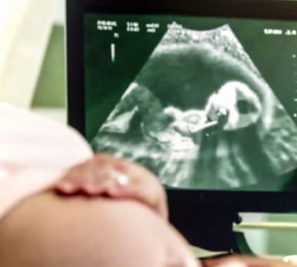 УЗИ плода