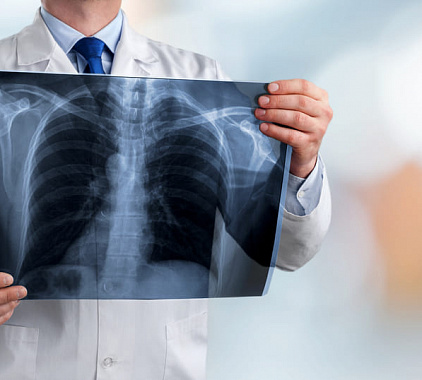 Рентгенография