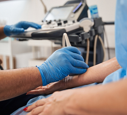 УЗИ артерий руки УЗИ артерий руки